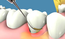El periodonto